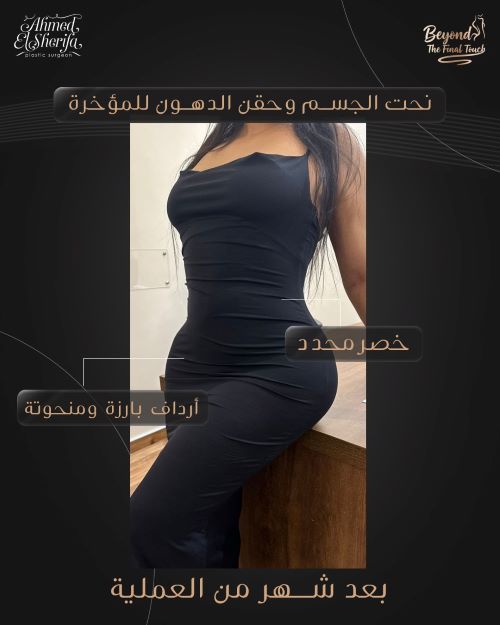 نحت الجسم في الرياض بخبرة د. أحمد الشريفة